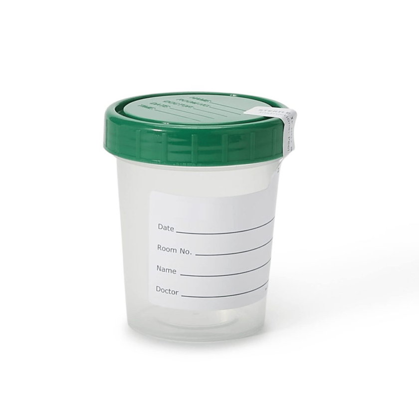 urine-cup